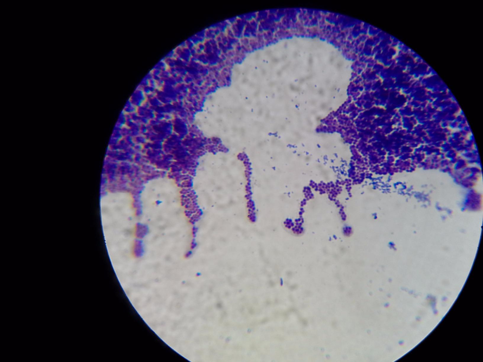 OMAX M82ES-SC100-LP100-OM 2000X LED Binocular Compound Lab Microscope, 40X-2000X, Double Layer Mechanical Stage customer photo 1