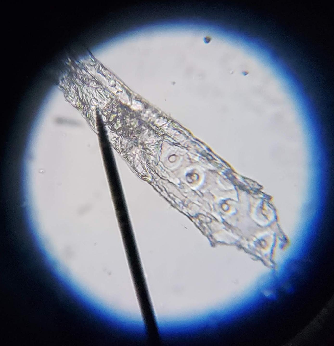 AmScope M150C 40X-1000X All-Metal Optical Glass Lenses Cordless LED Compound Biological Microscope customer photo 1