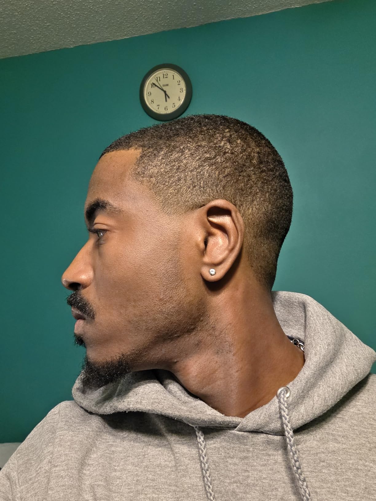 BaBylissPRO COREFX Professional Performance Hair Clipper customer photo 1