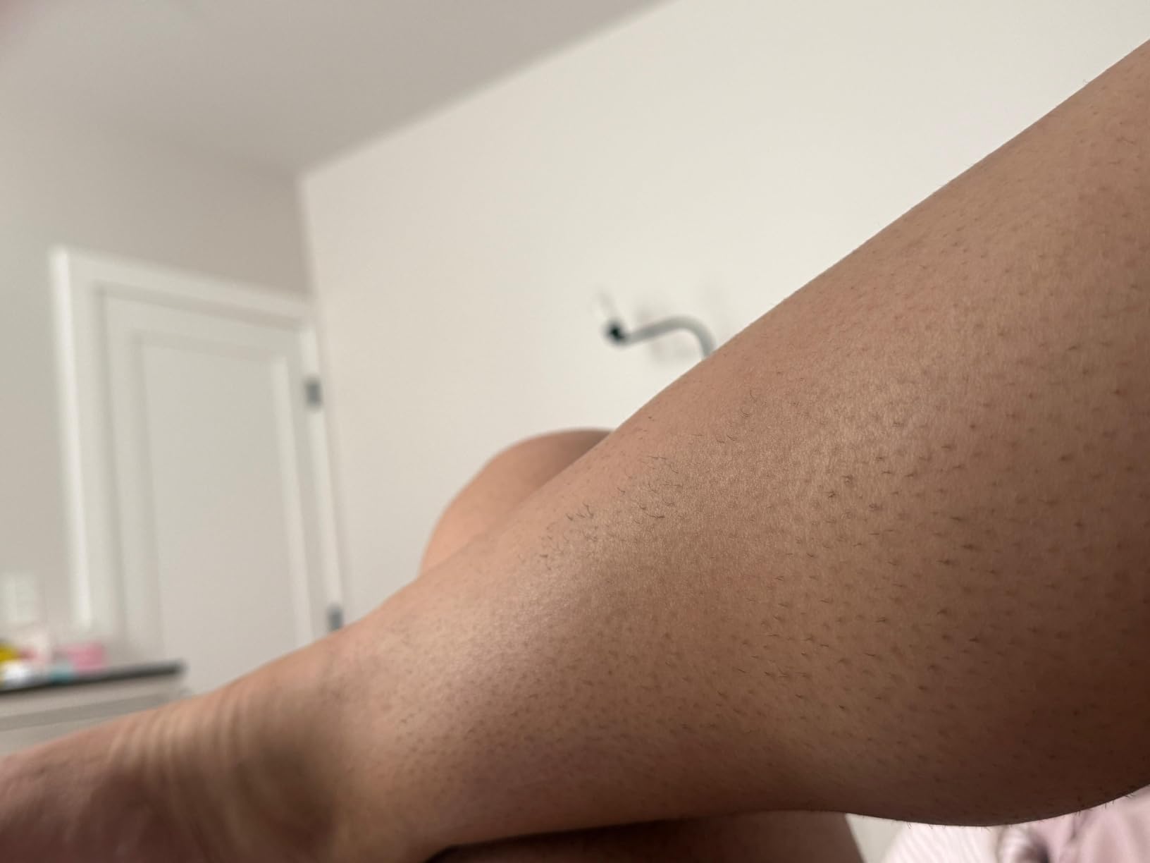 Philips Lumea IPL — Salon-Like Laser Hair Removal for Women, Permanent Hair Reduction Device At Home for Face & Body — Safe & Painless for Face, Bikini, Body, 5 Settings & Skin Sensors, BRI984/03 customer photo 2
