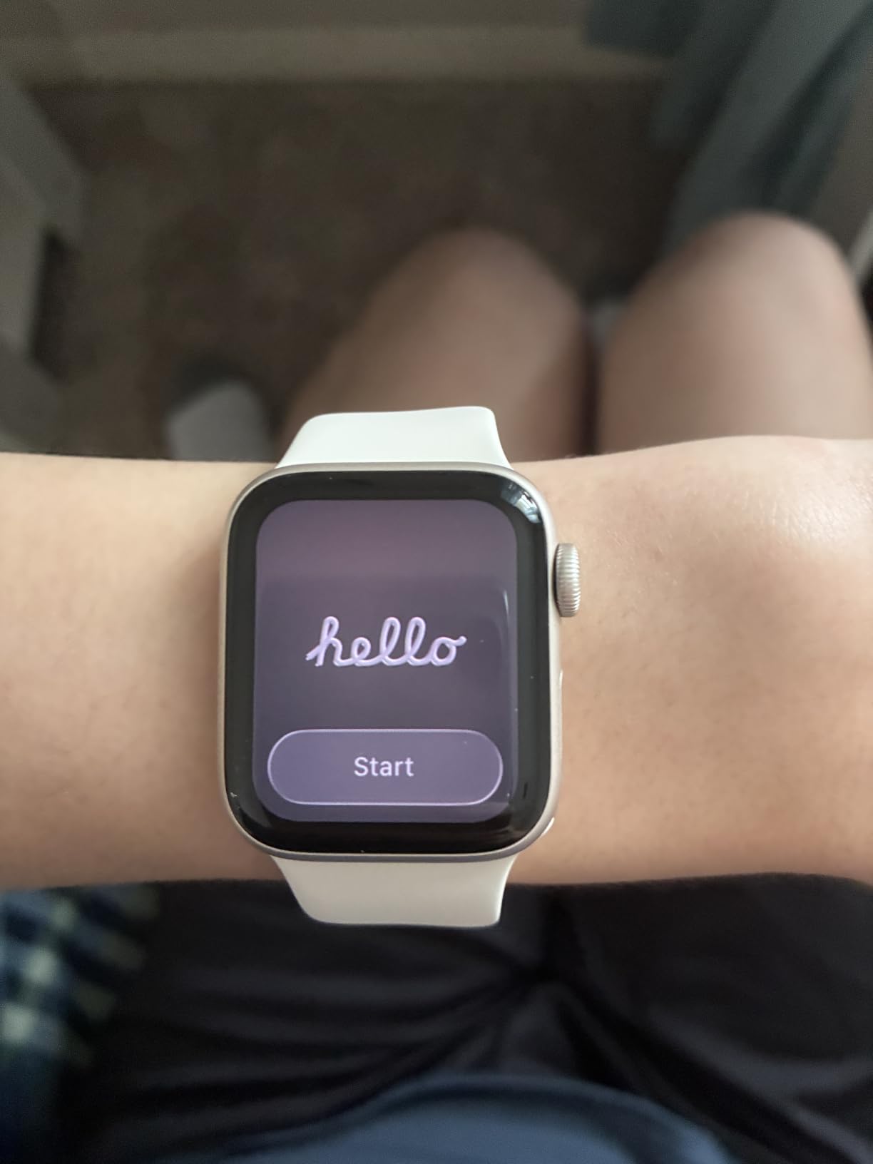 Apple Watch SE 3 GPS 40mm Smartwatch customer photo 1